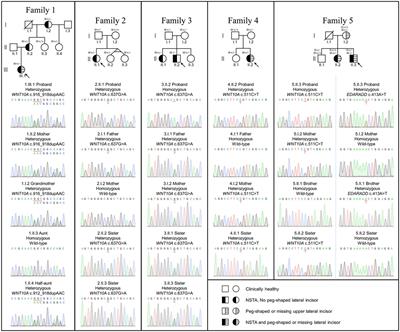 Phenotypic and Genotypic Features of Thai Patients With Nonsyndromic Tooth Agenesis and WNT10A Variants